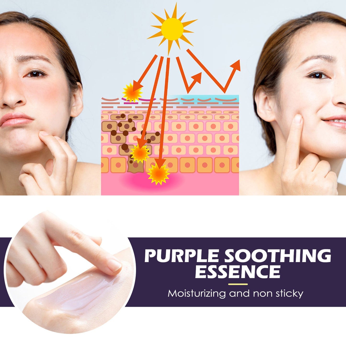 EELHOE Multi-Purple Repair Essence ជួសជុលរបាំងស្បែក បំបាត់ស្នាមអុចខ្មៅ ធ្វើអោយស្បែករលោង ផ្តល់សំណើមដល់ស្បែក 