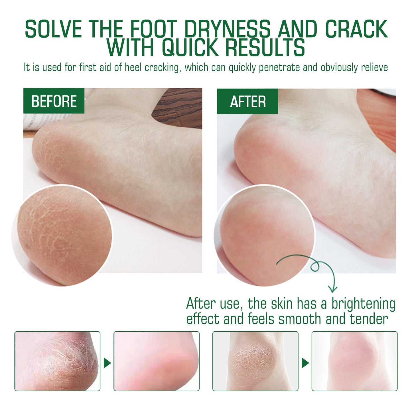 OUHOE Heel Crack Care Cream Repair Heel Peeling and Anti-Dry Cracked Foot Moisturizing Care Foot Cream 