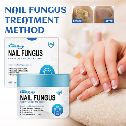 South Moon Nail Repair Cream Repairs Onychomycosis, Brightens Nails, Thickens Nails, Moisturizing Care Cream for Hand and Foot Nails 