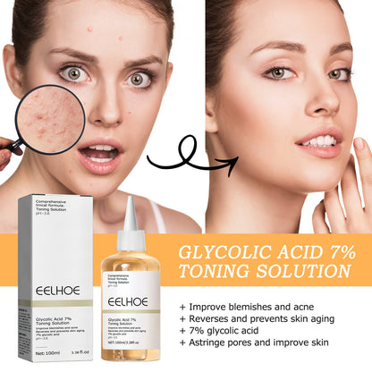 EELHOE glycolic acid 7% toner removes acne, fades acne marks, removes closed comedones, repairs skin, moisturizes and rejuvenates skin 