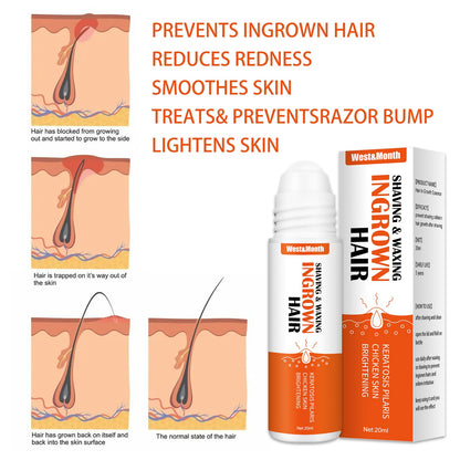 West&amp;Month Anti-Ingrown Hair Serum Anti-Shaving Bumps Ingrown Hair Serum After Shaving 