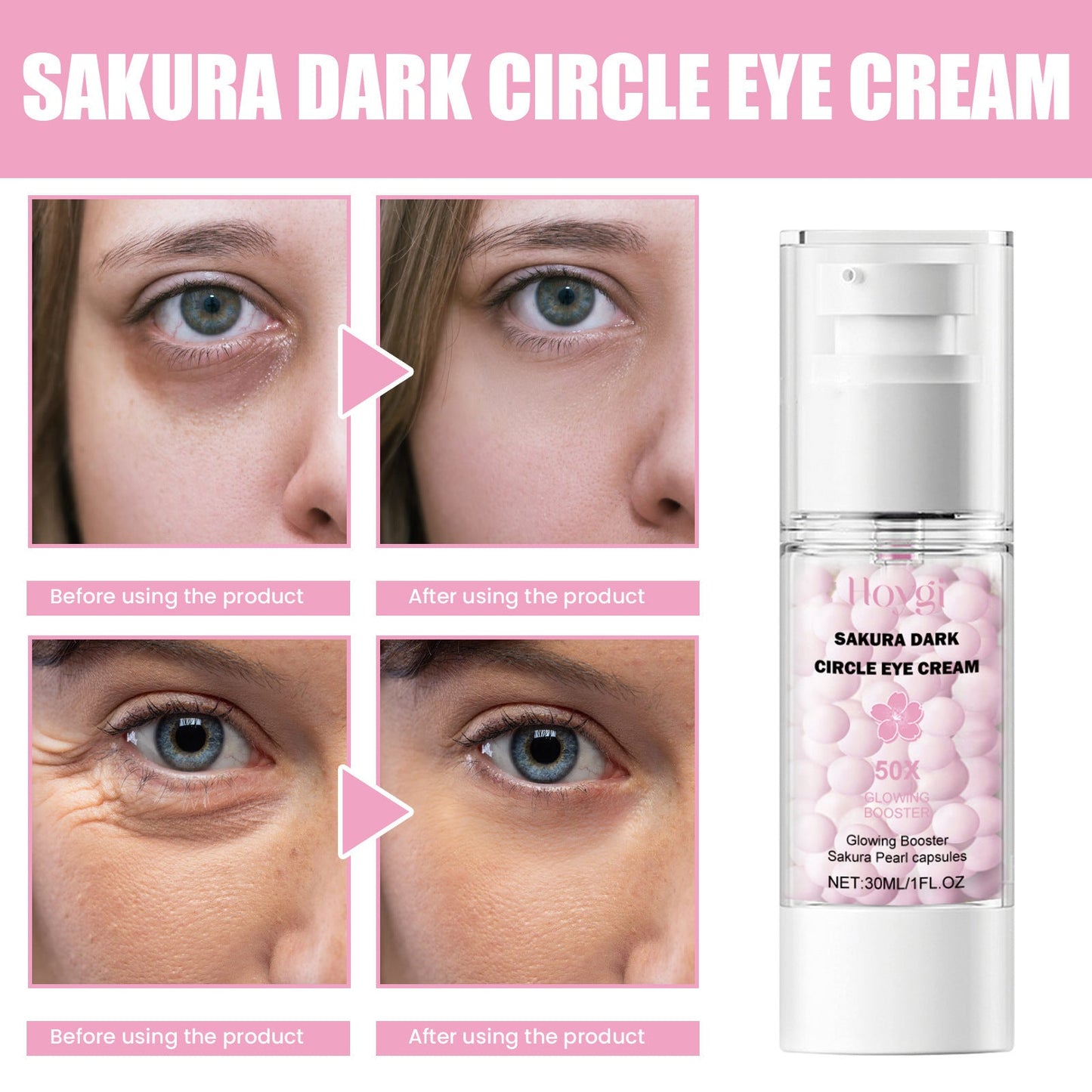 Hoygi Sakura Dark Circle Eye Cream ជួយកាត់បន្ថយរង្វង់ភ្នែកខ្មៅ និងរង្វង់ភ្នែក ធ្វើអោយស្បែកភ្លឺថ្លា ផ្តល់សំណើម បង្រួមរន្ធរោម 