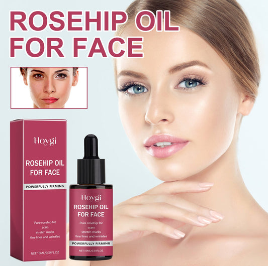 ប្រេងសំខាន់ៗ hoygi rosehip បង្រួមរន្ធញើស ជួសជុលផ្ទៃមុខ ផ្តល់សំណើម និងបំបាត់មុន និងមុនក្បាលខ្មៅ 