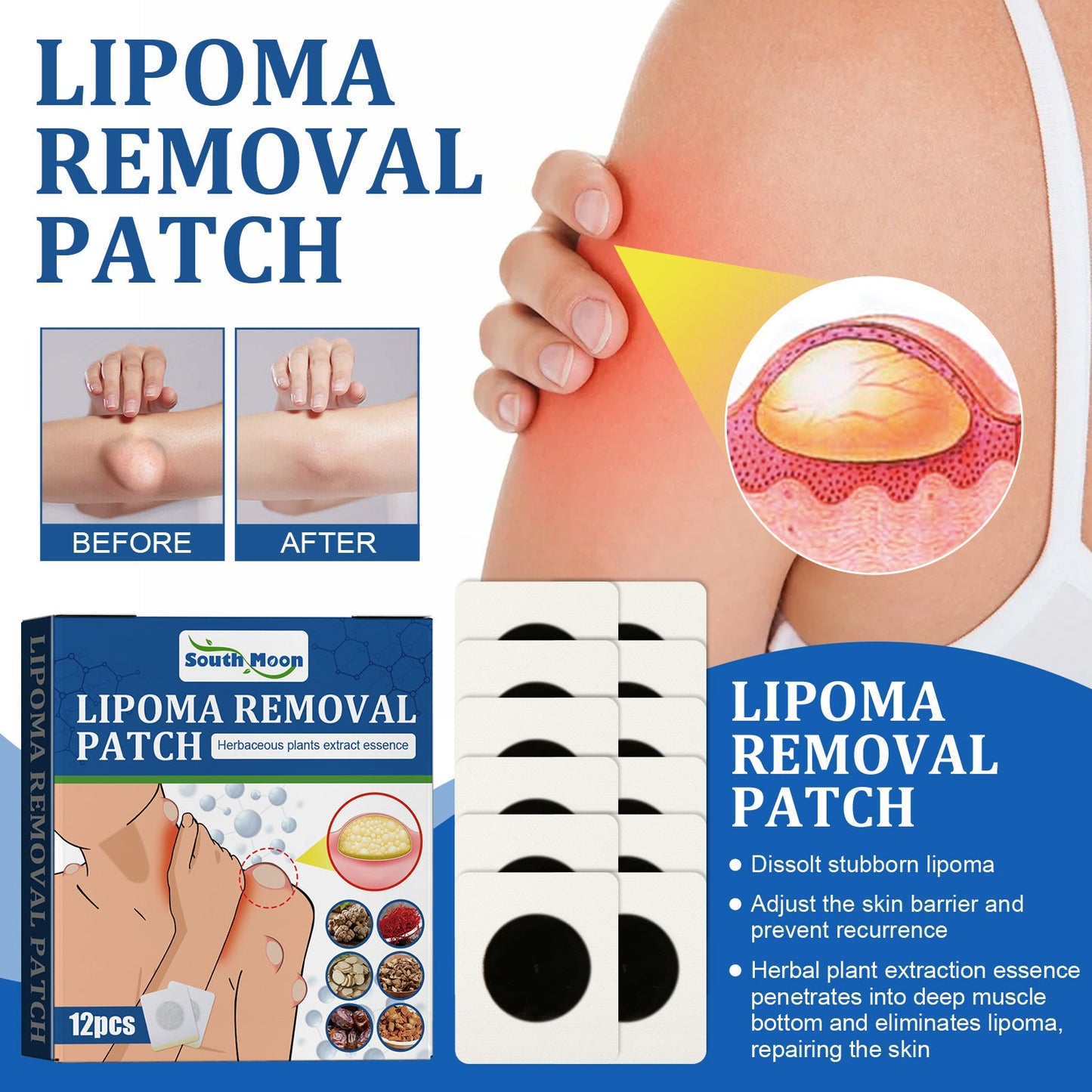 South Moon Cellulite Repair Patch Soothes Subcutaneous Lumps Body Various Cellulite Dissolving Care Patch 