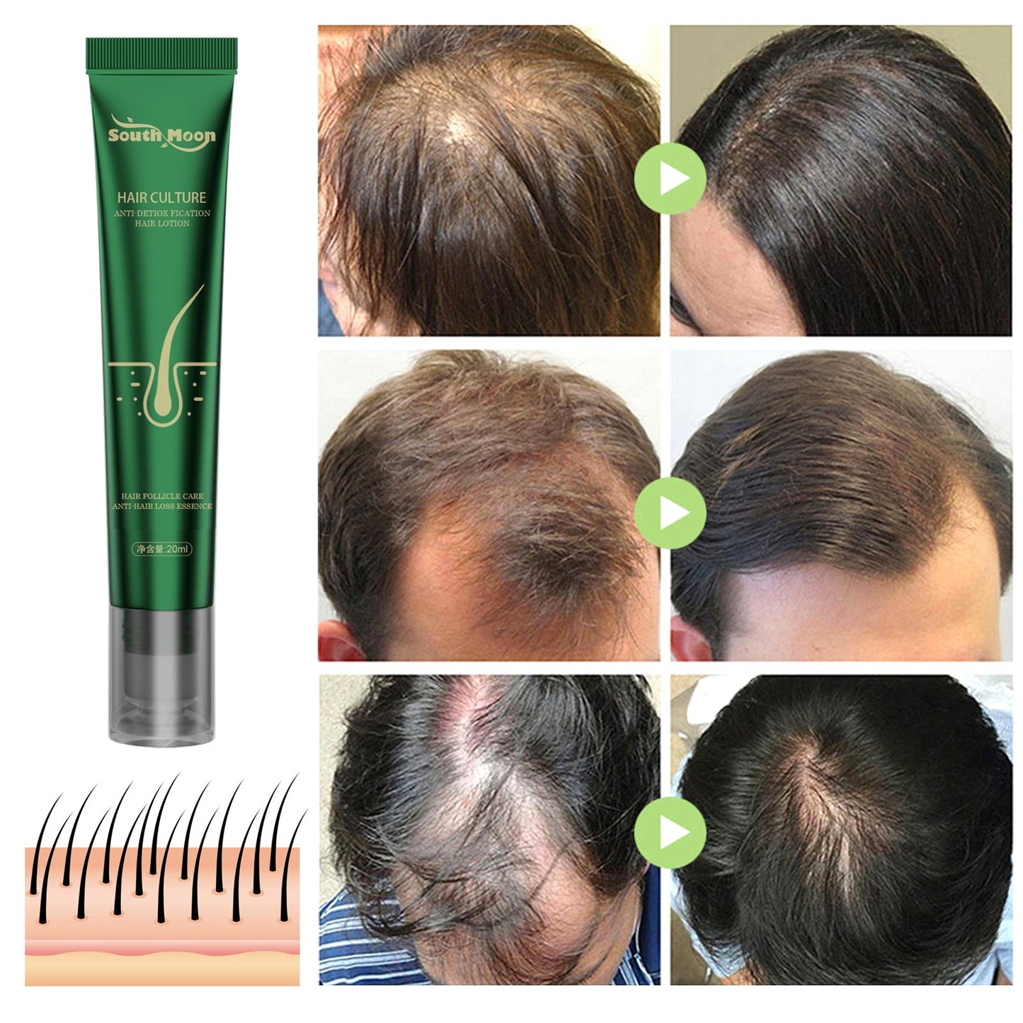 South Moon Anti-hair loss treatment solution strengthens hair, prevents hair breakage, ginger hair root care, damage repair 