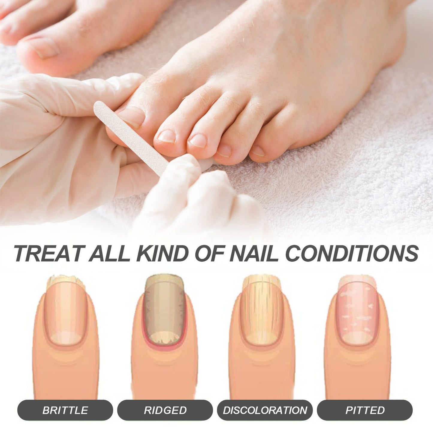 OceAura nail care oil repairs onychomycosis, soft nails, bright nails, nail thickening, jasmine type 