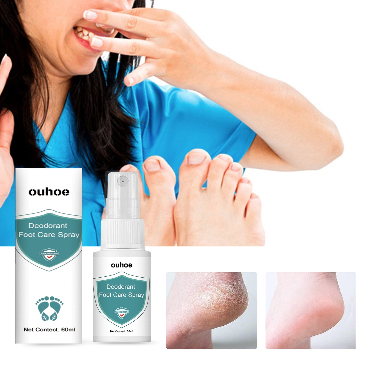 OUHOE Foot deodorant spray, ប្រឆាំងនឹងការរមាស់ជើង, ជើងរបស់អត្តពលិកនិងក្លិនប្រឆាំងនឹងការស្ងួតនិង peeling moisturizing care spray 