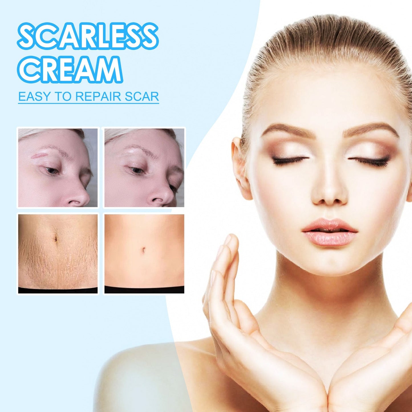 EELHOE scar removal cream repairs the skin, fades scars, smoothes the skin, removes scars from pregnancy and surgery 