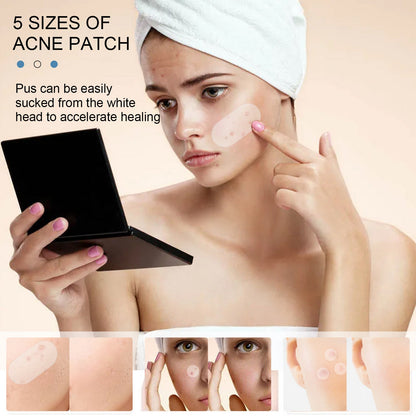 EELHOE acne patch invisible acne patch anti-acne closed comedones waterproof makeup concealer hydrocolloid oil acne patch 