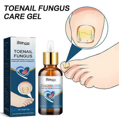 EELHOE Toenail Care Gel Yellow and Thickened Hand and Foot Nails Soft Nail Polishing Nail Care Gel 