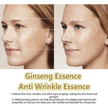 EELHOE Ginseng Polypeptide Anti-Wrinkle Essence ជួយកាត់បន្ថយភាពជ្រីវជ្រួញ និងបន្តឹងស្បែកមុខ ធ្វើអោយស្បែកទន់ រលោង និងយឺត។ 