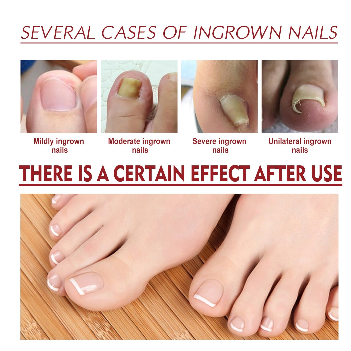 Jaysuing Anti-nail groove relief oil Soft nails Bright nails Repair ingrown nails Thickening type onychomycosis nail groove care oil 