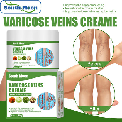 South Moon Varicose Vein Repair Cream Legs Earthworm Legs Blue Veins Raised Relieve Pain Leg Care Massage Cream 