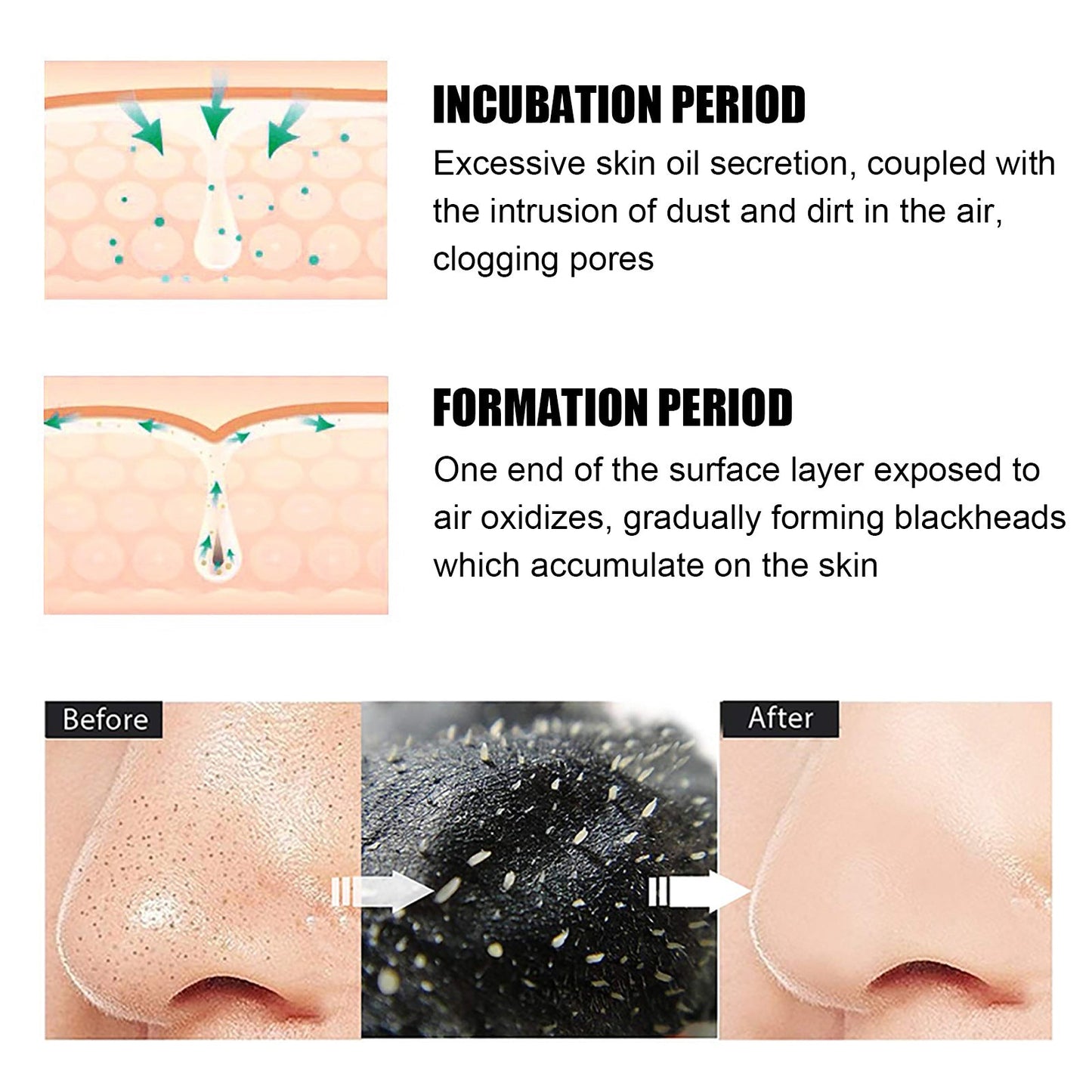 Black pig nose patch bamboo charcoal blackhead removal nose mask nose patch acne removal set box blackhead removal tear off nose mask patch 