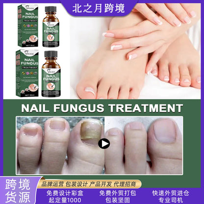 EELHOE nail repair liquid hand and foot repair liquid gray nail liquid concave and convex thick nail thickening type gray nail soft nail 