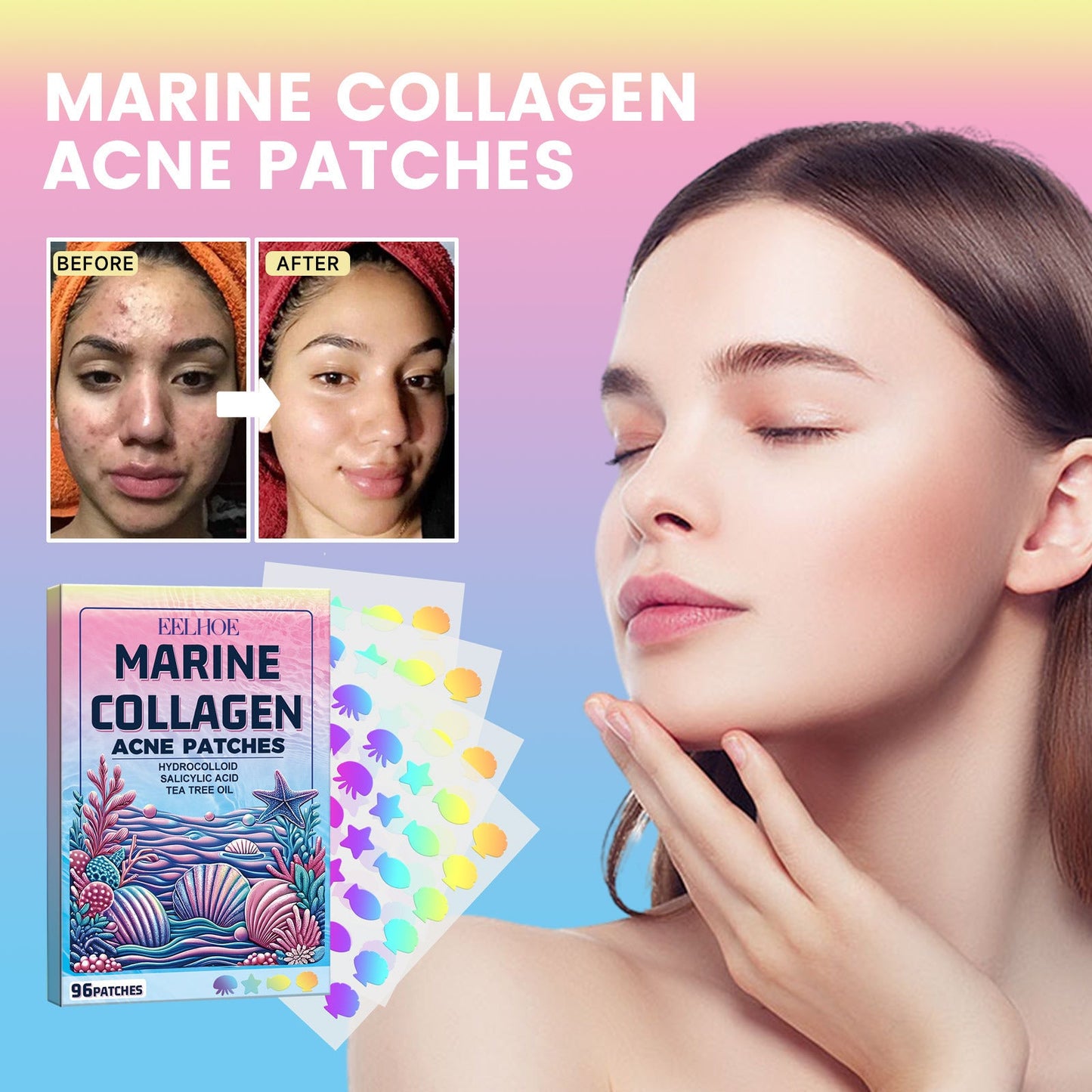 EELHOE cute color anti-acne patch to clean facial acne and pimples in multiple shapes and portable acne patches 