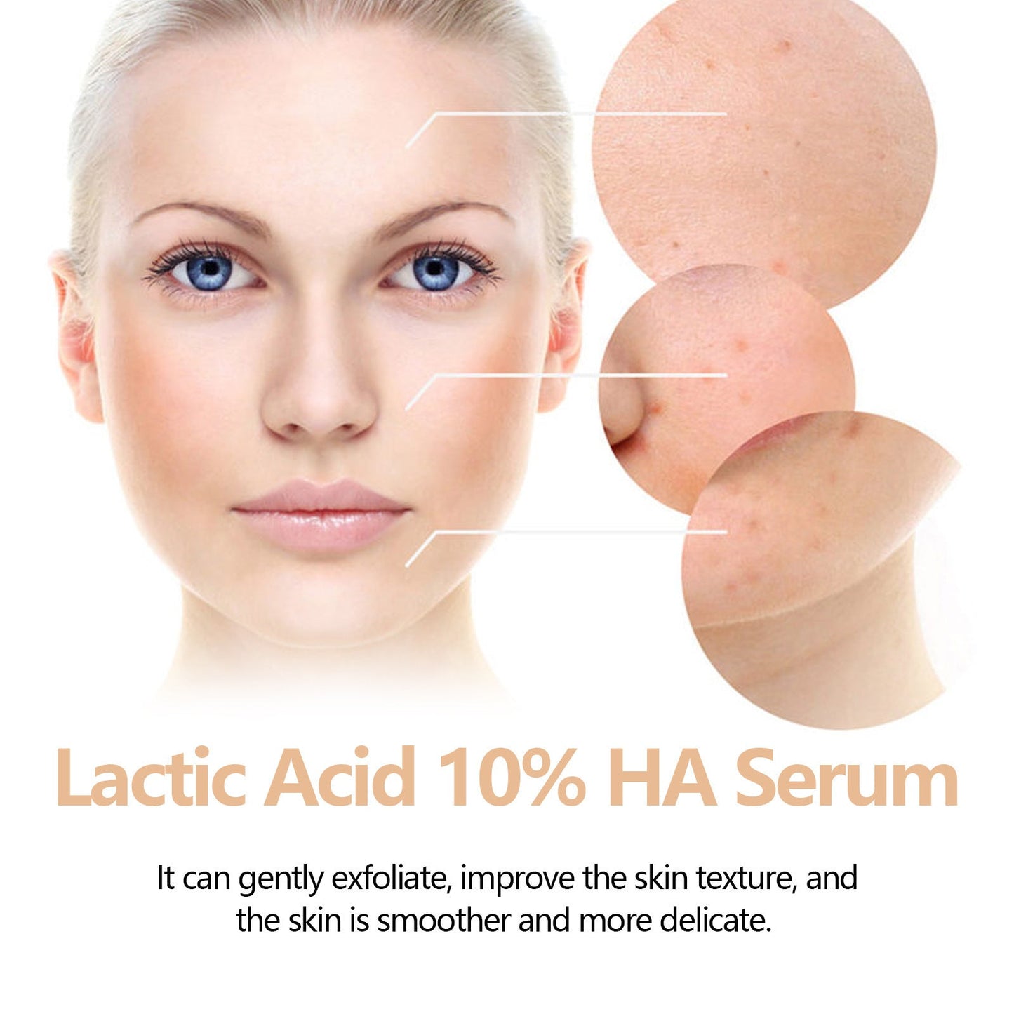 Hoygi lactic acid facial essence fades acne and blackheads, anti-wrinkle, moisturizing, whitening and anti-aging 