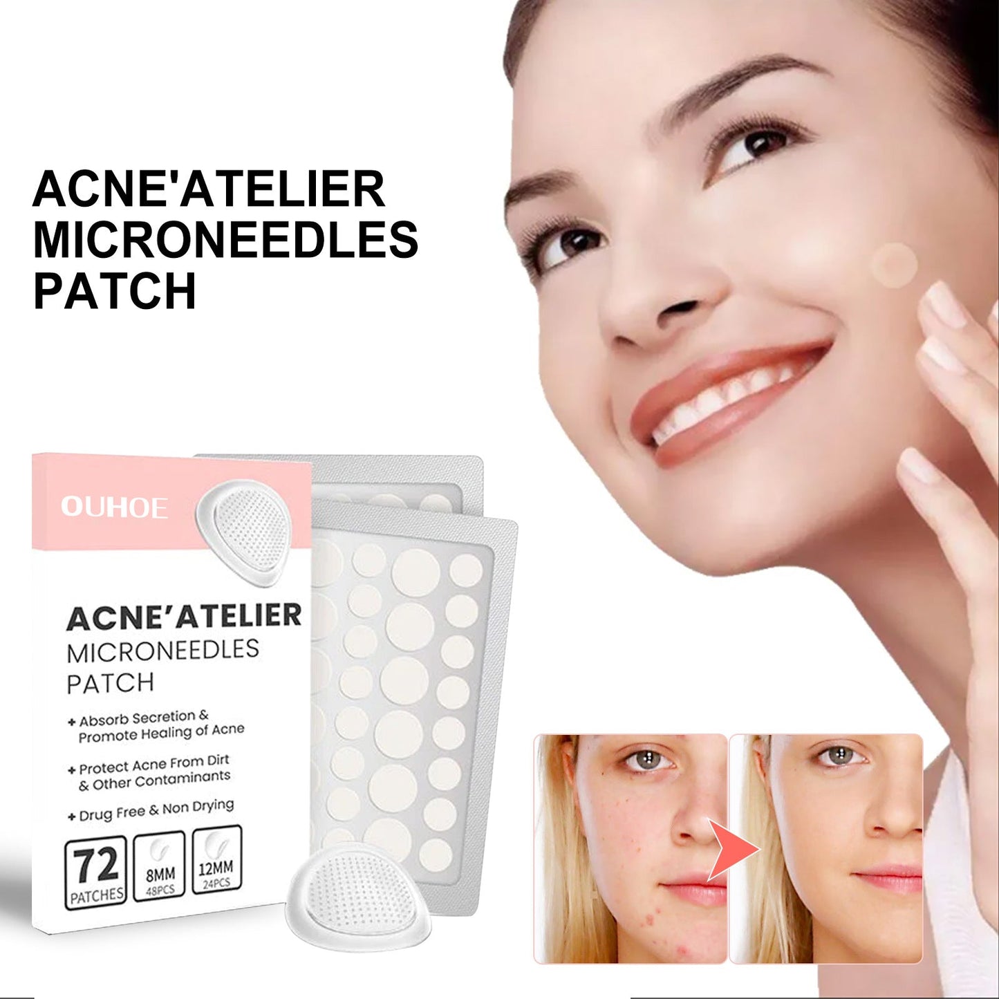 OUHOE acne patch for face redness repair acne blackheads clean pores moisturizing smooth skin acne patch 