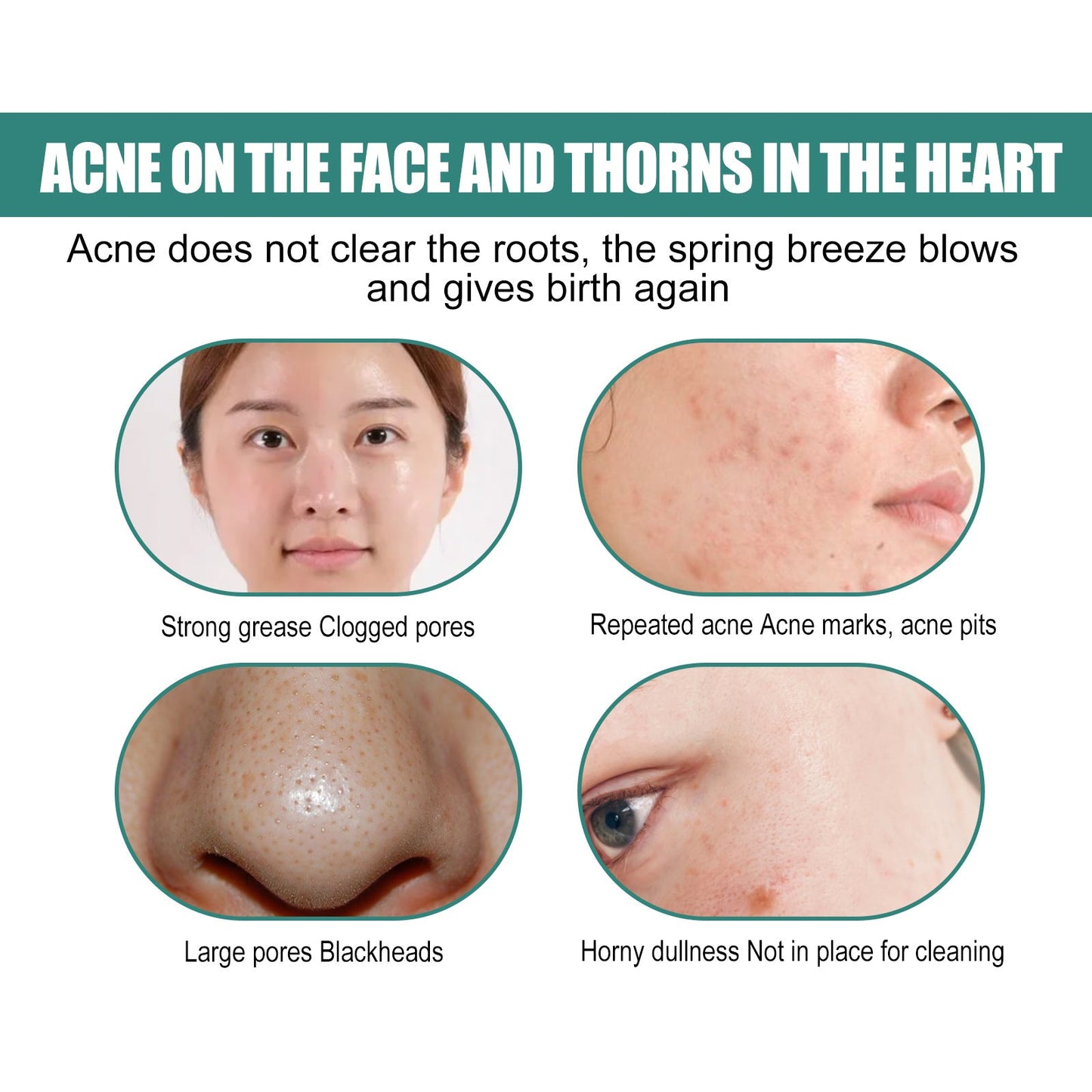 EELHOE Moon Acne Patch ជួសជុល សម្អាត និងបិទស្នាមជាំ អាចម៍រុយ មានច្រើនពណ៌ ងាយស្រួលប្រើ 