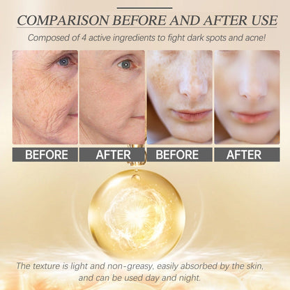 EELHOE Retinol Collagen Cream Lightens Fine Lines and Melanin Firms Skin Evens Out Skin Tone Moisturizing Cream 