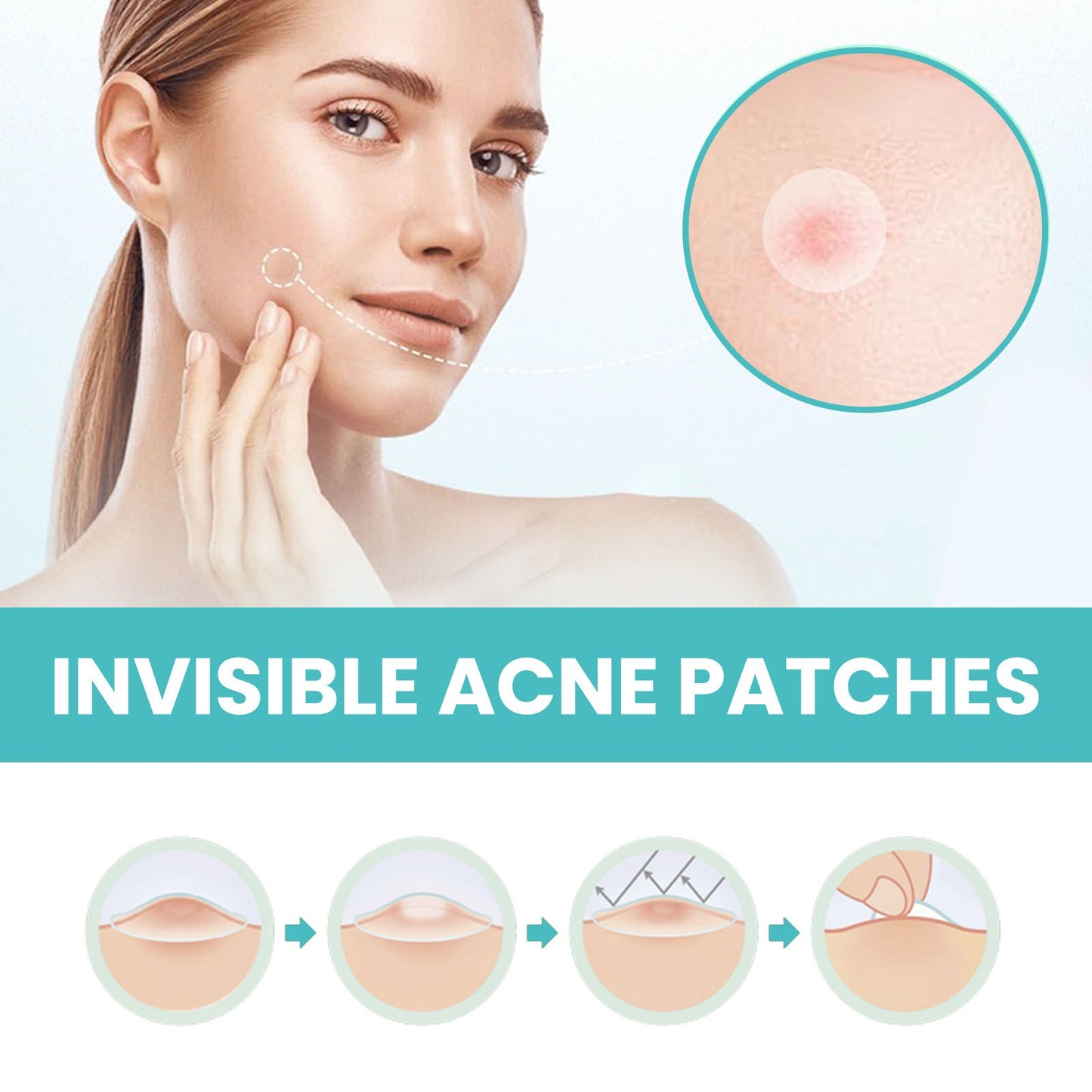 West&amp;Month Acne Patch Repairs Acne Pimples Cleans Pores Invisible Breathable Concealer Waterproof Acne Cleansing Patch 