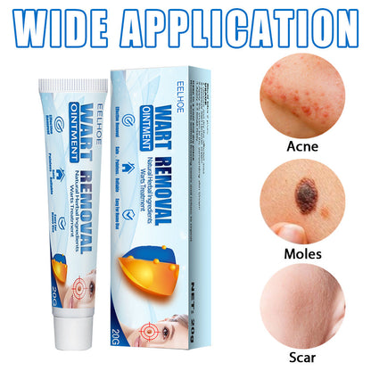 EELHOE Wart Cream Cleansing Skin Repair Care Body Face Removal Face Tag Keyou Cream 