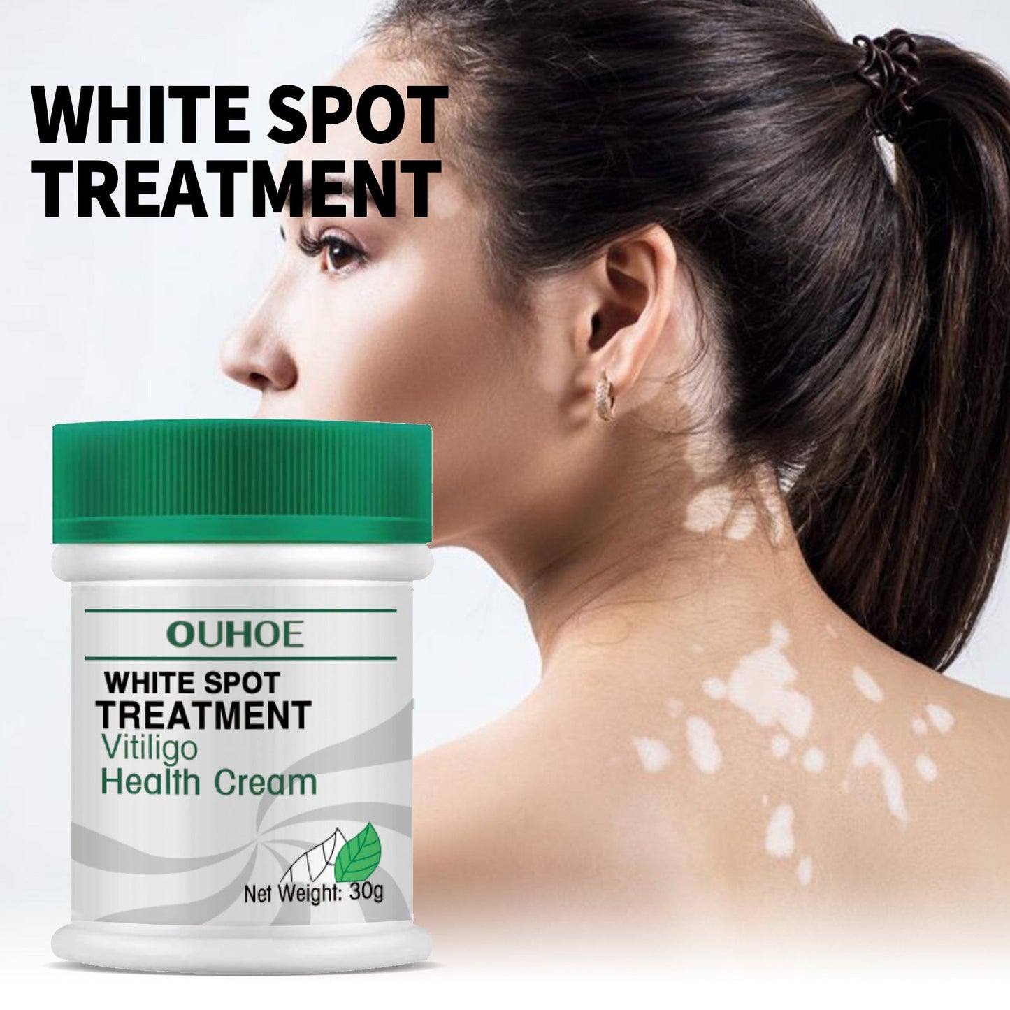 OUHOE white spot repair cream repairs and fades white spots, melanin, hand and foot moss skin external care cream 