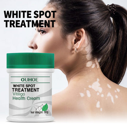 OUHOE white spot repair Cream ជួសជុល និងបំបាត់ស្នាមអុចខ្មៅ មេឡានីន ស្បែកដៃ និងជើង ក្រែមថែរក្សាខាងក្រៅ 