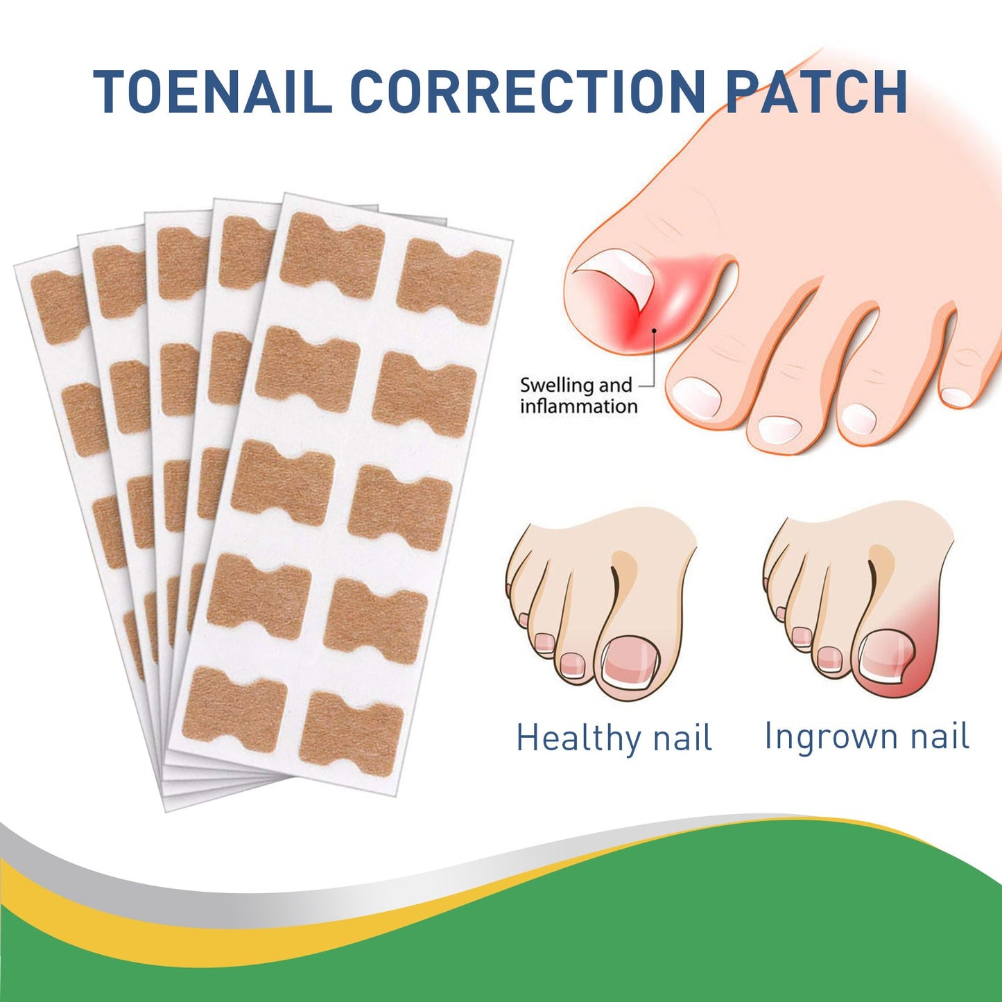 Jaysuing Toenail Groove Correction Stickers Toe Ingrown Nails Correction Pull-Up Stickers Nail Repair Stickers Nail Art 