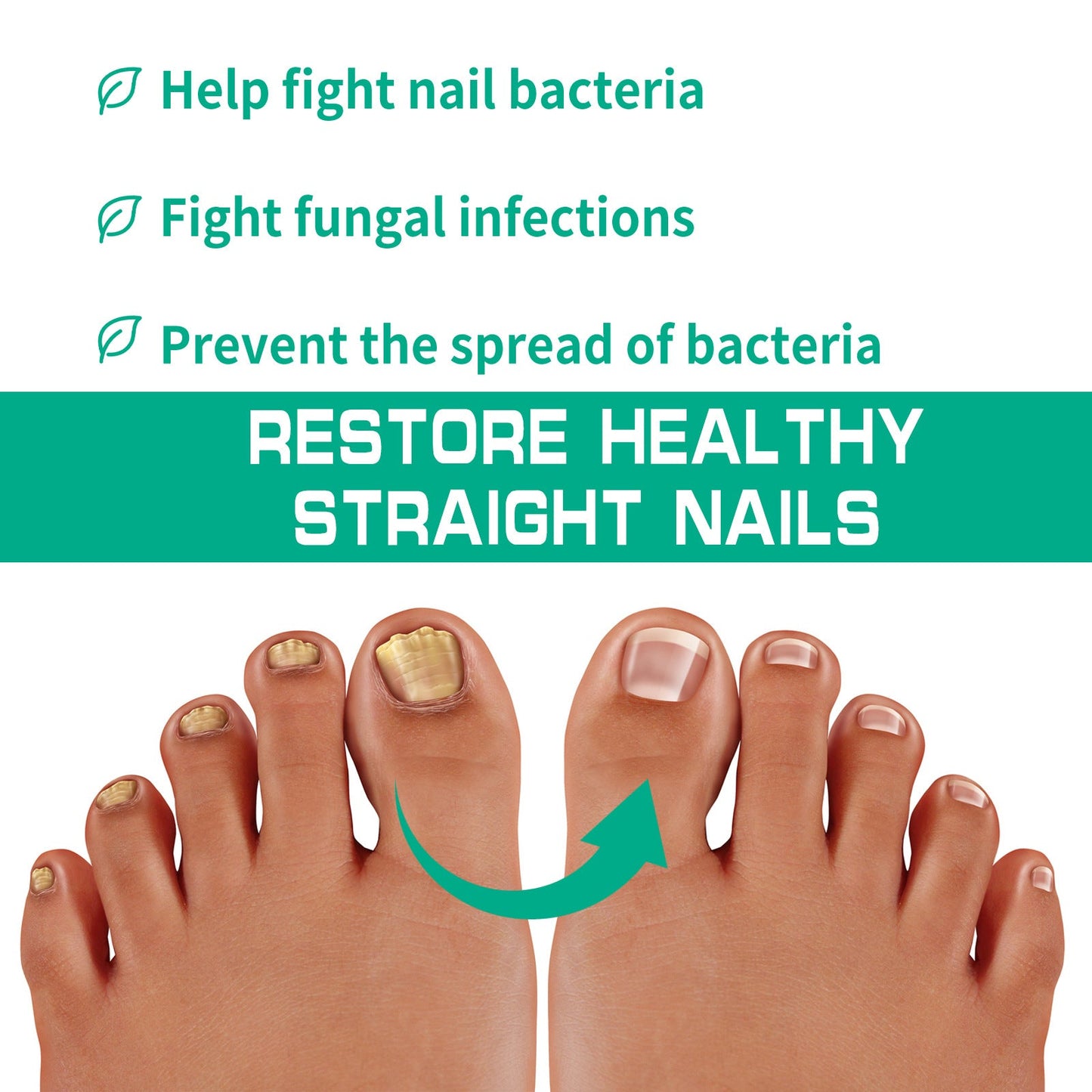 South Moon Onychomycosis Cream Care Hand, Foot, and Toenail Thickening Bright Nail Onychomycosis Repair Soft Nail Cream 