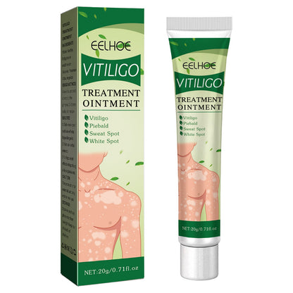 EELHOE white spot skin repair cream បំបាត់ស្នាមអុចខ្មៅ ស្នាមសង្វារ រលាកស្បែកដៃ និងជើង ជួសជុលស្បែក white spot net ointment 