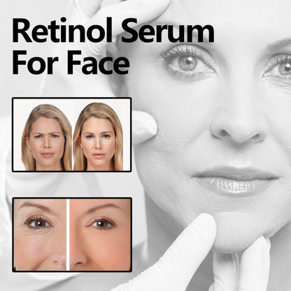 Hoygi Facial Retinol Serum ផ្តល់សំណើម និង បន្តឹងស្បែកមុខ បន្តឹងស្បែកមុខ បន្តឹងស្បែក ប្រឆាំងភាពជ្រីវជ្រួញ 