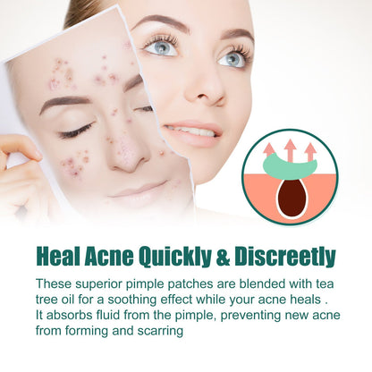 EELHOE Moon Acne Patch ជួសជុល សម្អាត និងបិទស្នាមជាំ អាចម៍រុយ មានច្រើនពណ៌ ងាយស្រួលប្រើ 