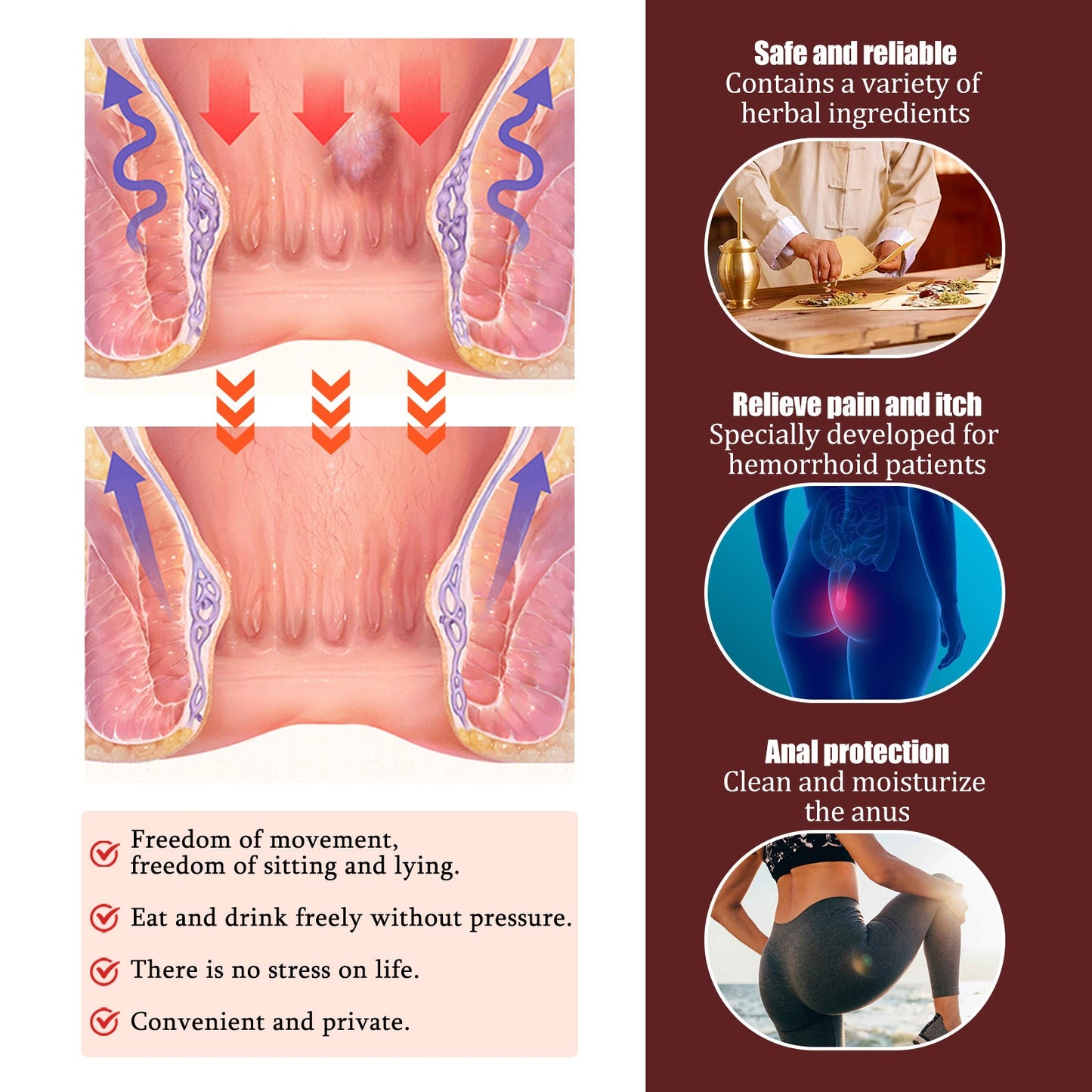 South Moon Hemorrhoid Soothing Cream Eliminates Anal Swelling, Pain, Itching Herbal Cream Gel Hemorrhoid Cream 