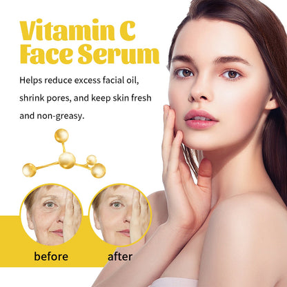 West&amp;Month Vitamin C Facial Essence បំបាត់ស្នាម បង្រួមរន្ធញើស ផ្តល់សំណើម និងប្រឆាំងភាពចាស់ 