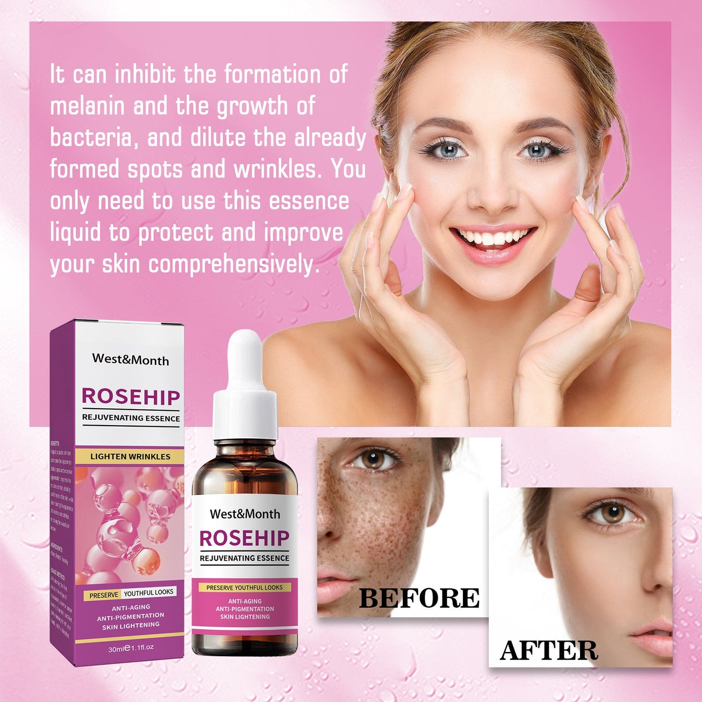 West &amp; Month Rosehip Skin Rejuvenation Essence reduces fine lines, moisturizes, tightens skin, brightens skin spots 