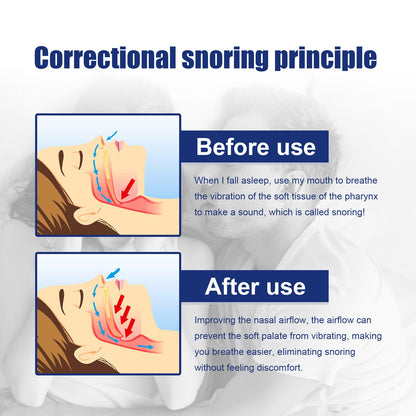 South Moon Anti-snoring Nasal Dilator Snoring Nostril Dilator Shaped Anti-snoring Ventilation Anti-snoring Corrector 