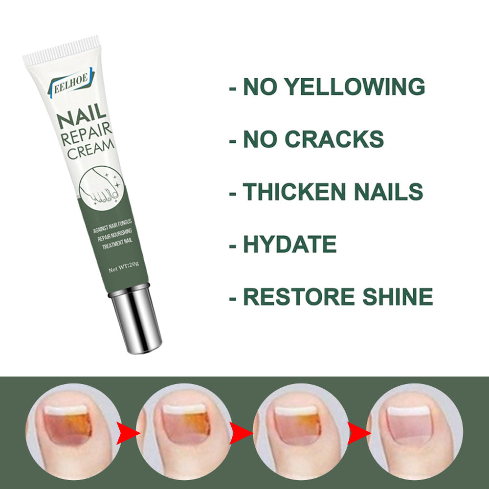 EELHOE Nail Care Cream Onychomycosis Hand and Foot Care Thickening Onychomycosis Soft Nail Cream 