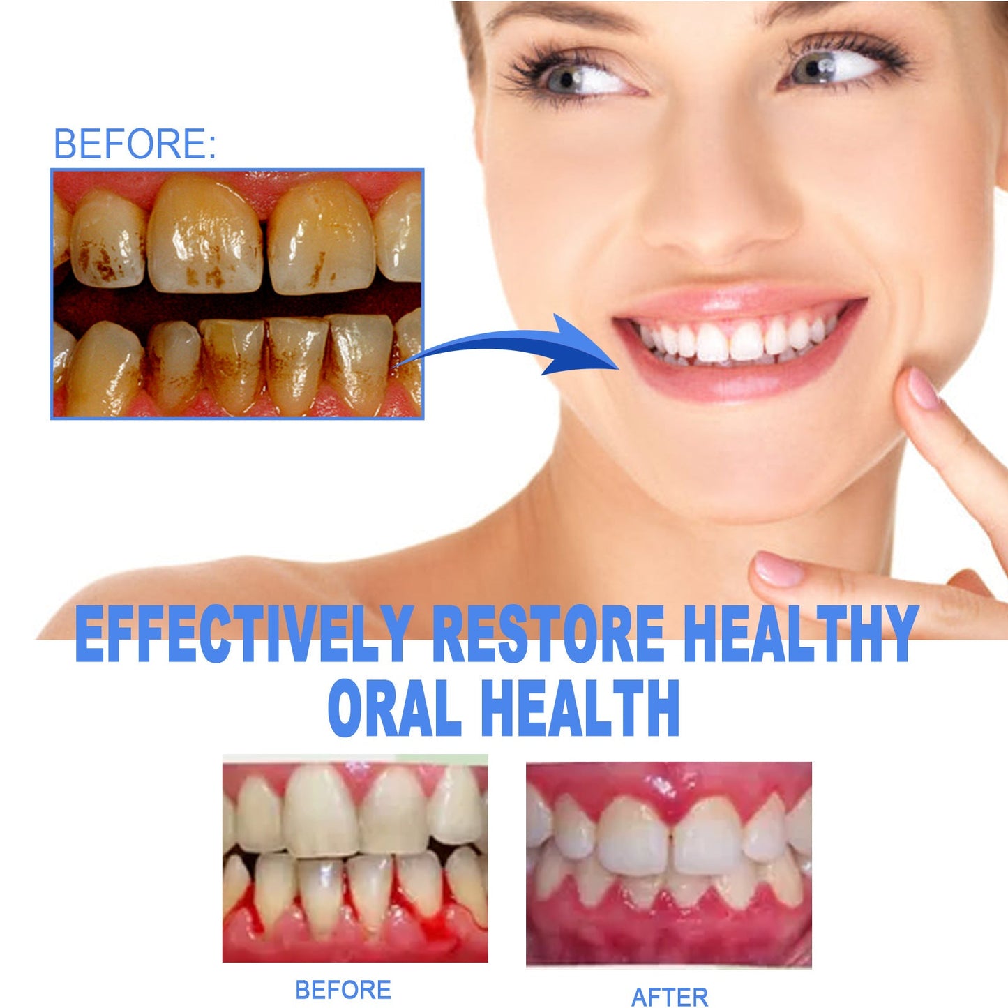 EELHOE Teeth Repair Gel ជួសជុលអញ្ចាញធ្មេញ ហើម និងឈឺ សំអាតធ្មេញបានជ្រៅ និង tartar Oral Care Gel 