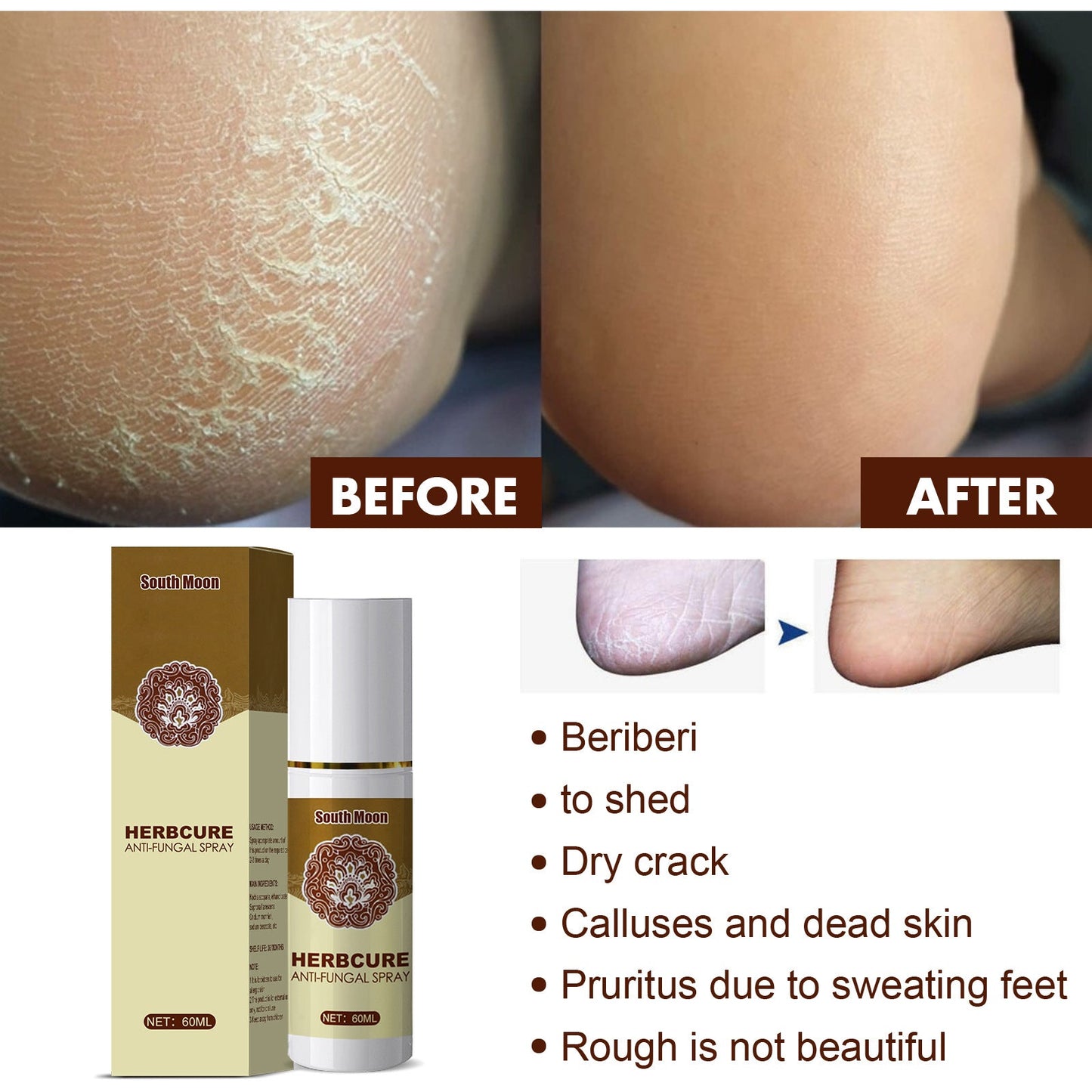 South Moon Herbal Foot Spray Foot Sweat Deodorizing Spray Dehumidifying Spray Foot Odor Care Spray 