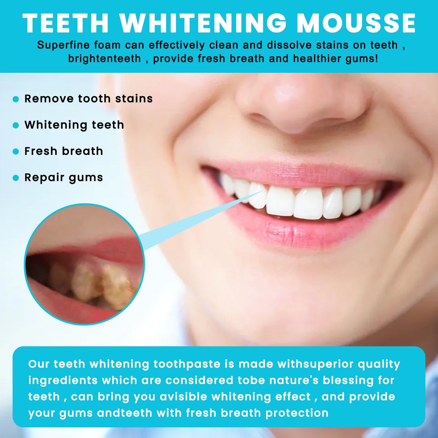 ថ្នាំដុសធ្មេញ OUHOE white teeth mousse សំអាត និងថែរក្សាអញ្ចាញធ្មេញ ធ្វើអោយខ្យល់ដង្ហើមស្រស់ថ្លា សំអាត tartar និងការពារការពុកធ្មេញក្នុងមាត់ 