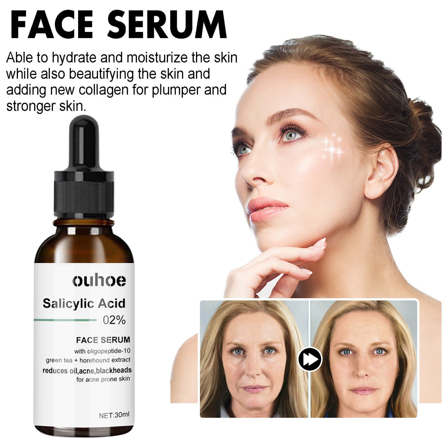 OUHOE anti-aging essence reduces fine lines, wrinkles, forehead lines, moisturizes and tightens the skin anti-aging essence 