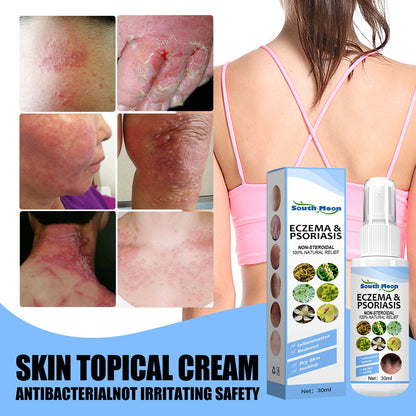 South Moon skin repair spray, psoriasis psoriasis skin external use athlete's foot spray skin antibacterial spray 