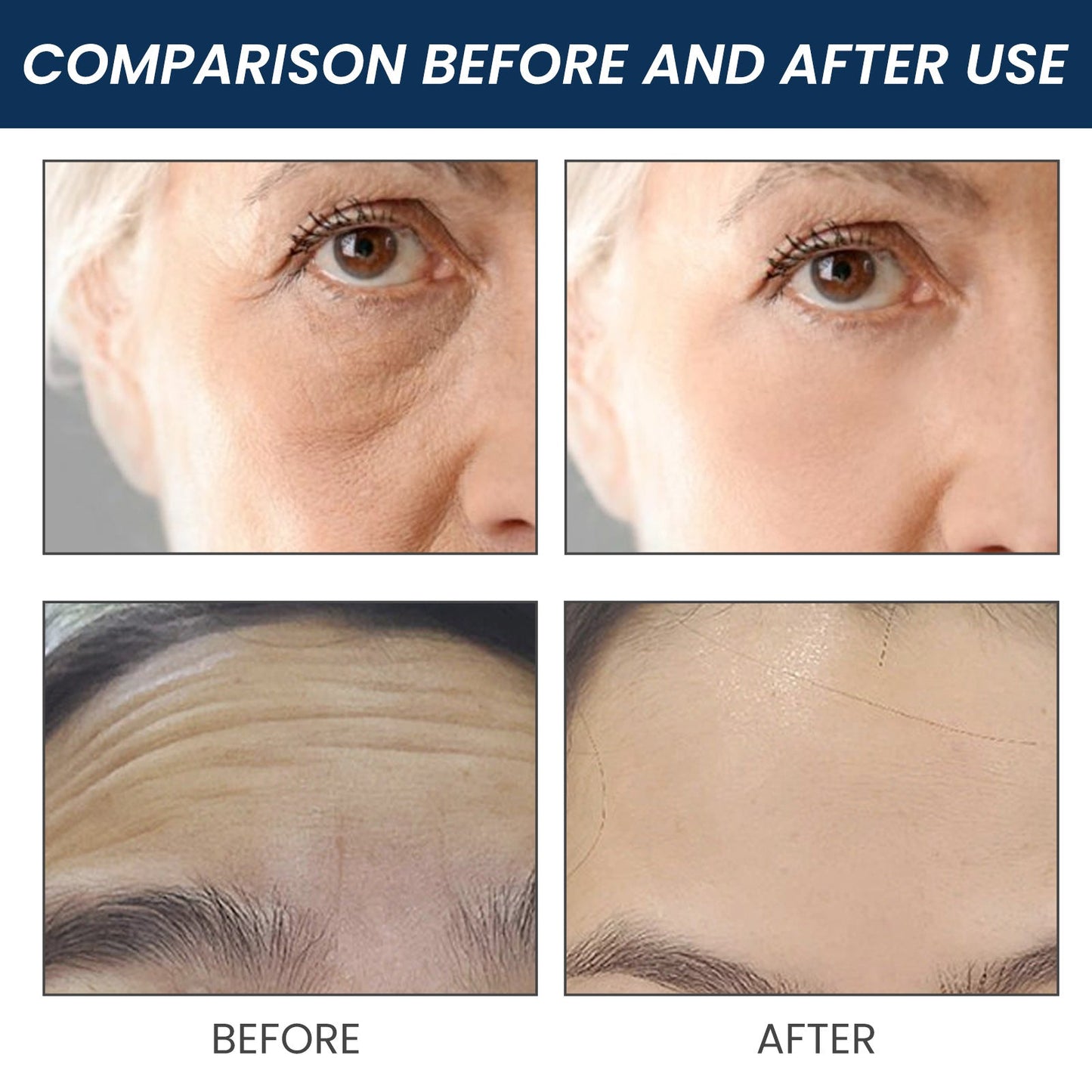 Jaysuing anti-wrinkle essence reduces fine lines around the eyes, facial nasolabial lines, wrinkles, massage, firming, anti-aging 