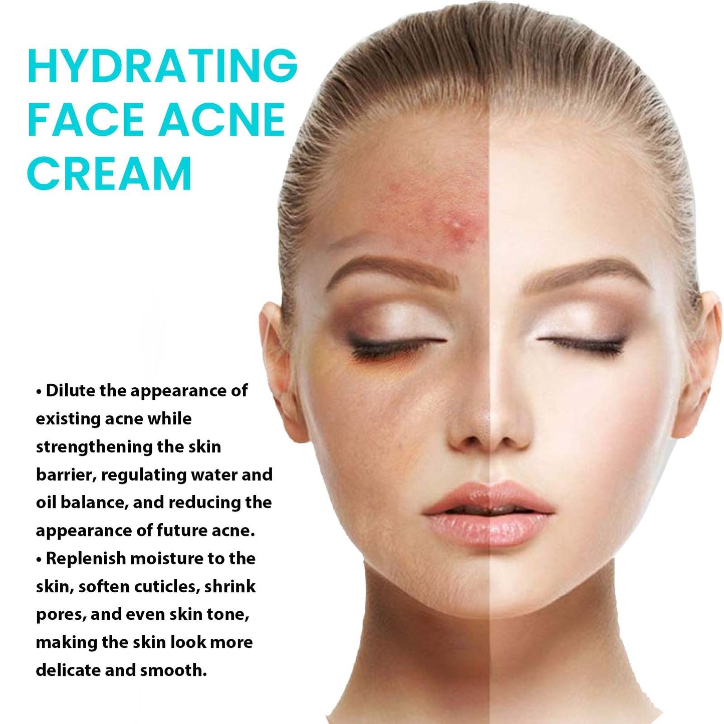 Jaysuing Whitening Anti-acne Cream Lightens acne and pimples, shrinks pores, moisturizes delicate skin, whitening cream 