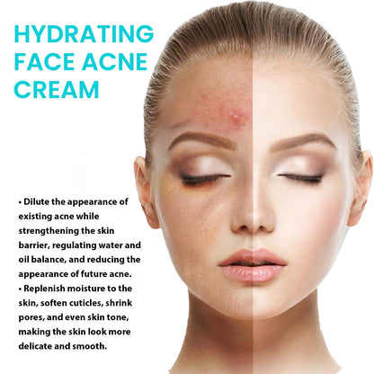 Jaysuing Whitening Anti-Acne Cream បំបាត់មុន ស្នាមមុន បង្រួមរន្ធញើស ផ្តល់សំណើមដល់ស្បែក ក្រែមធ្វើអោយស្បែកស 