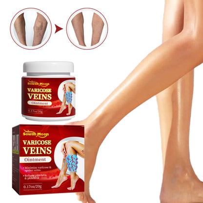 South Moon Leg Vein Repair Cream Varicose Massage Repair Earthworm Leg Blood Circulation Swelling Activation 