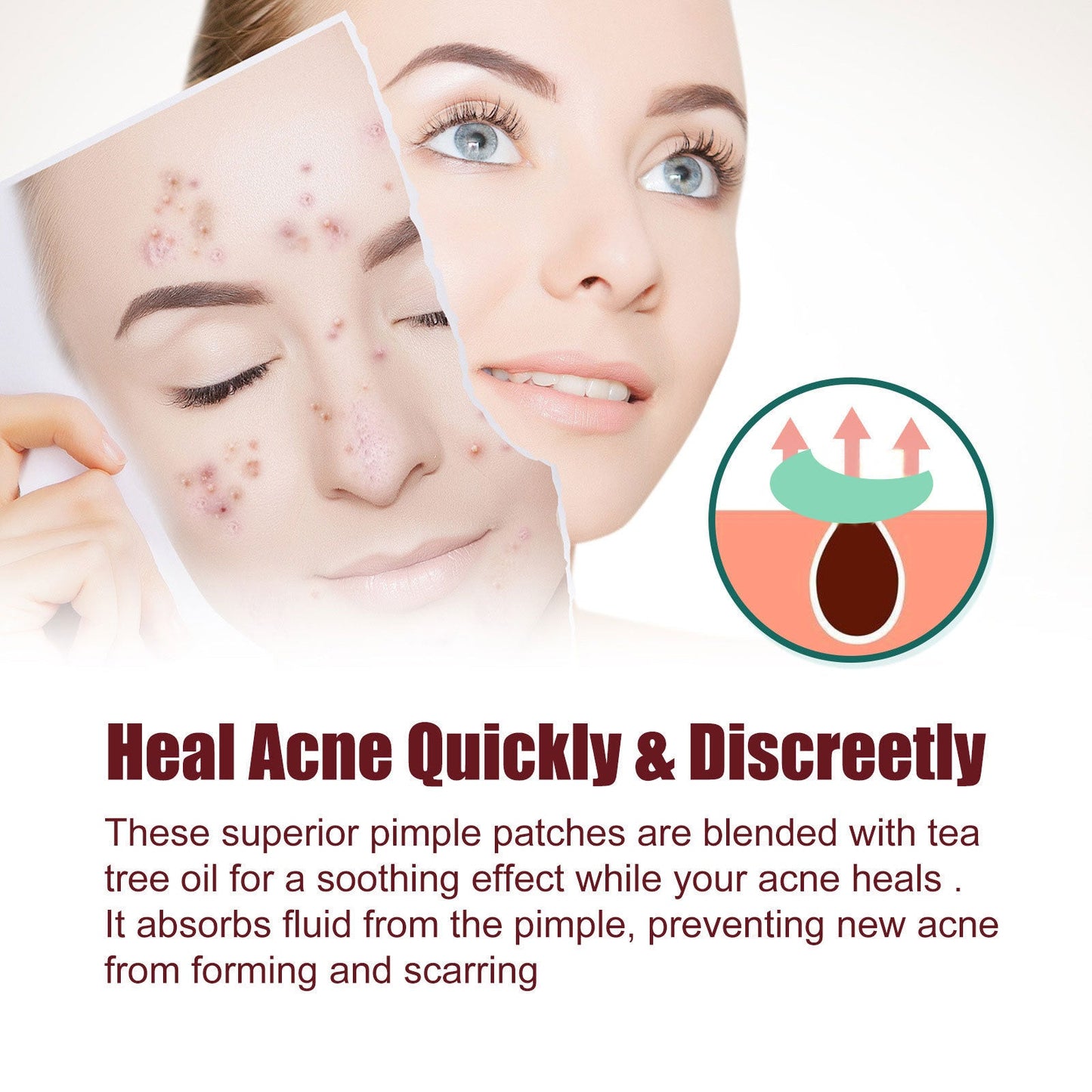 Jaysuing acne patch series repairs and cleanses closed comedones, gently reduces acne and balances the skin 