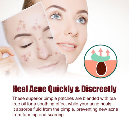 Jaysuing acne patch series repairs and cleanses closed comedones, gently reduces acne and balances the skin 