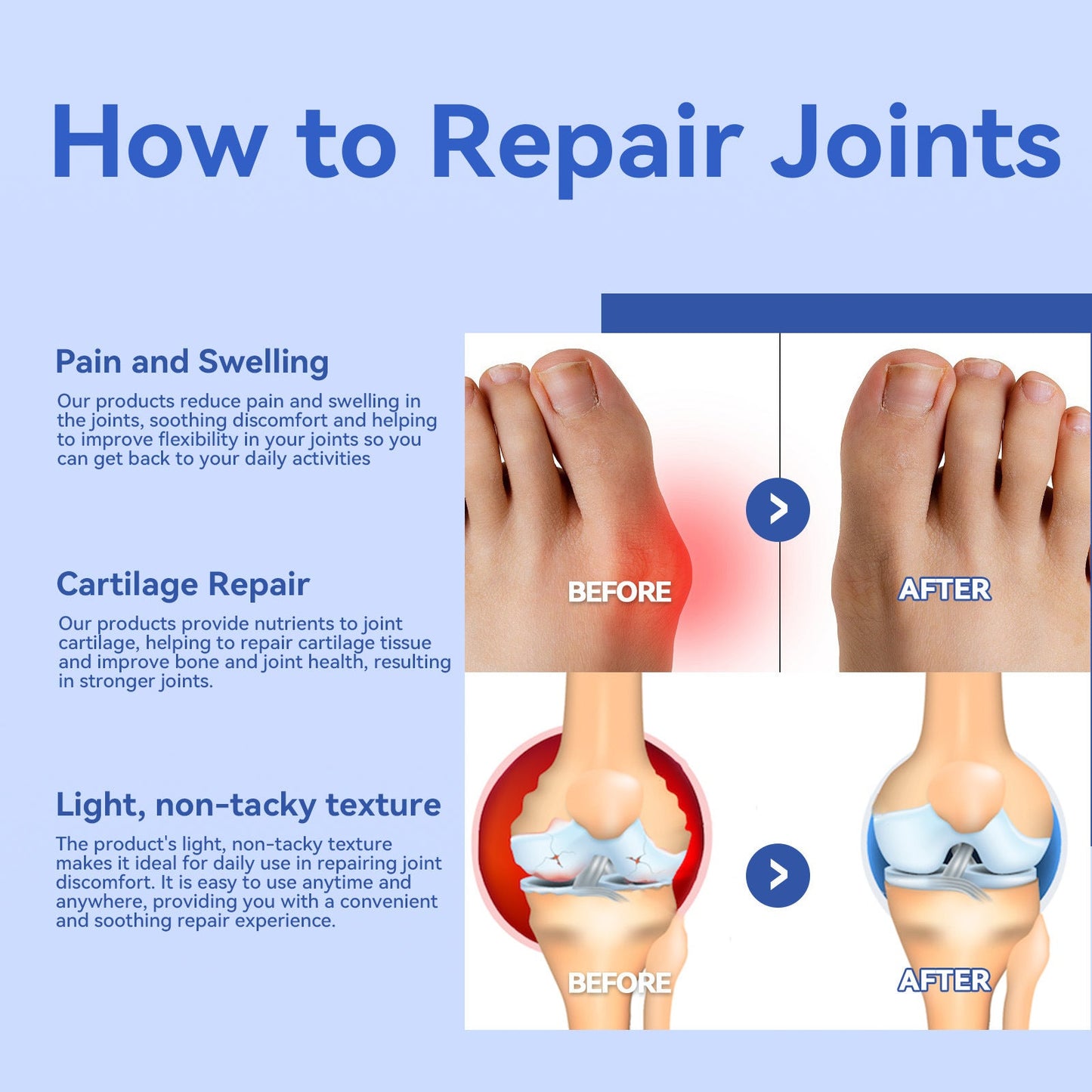 South Moon Cervical Joint Care Cream បំបាត់ការឈឺចាប់នៅឆ្អឹងខ្នងចង្កេះ ស្មា ក កដៃ និងសន្លាក់ជង្គង់។ 